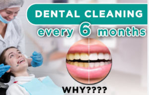 Six-Month Dental Cleanings