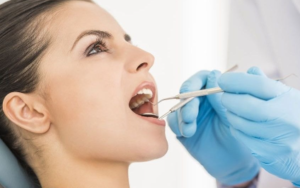 Teeth Cleaning Cost in Noida