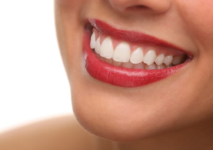 Teeth Cleaning Cost in Winnipeg