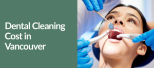 Teeth Cleaning Price in Vancouver