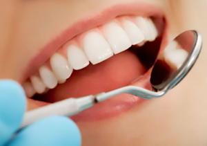 Teeth Whitening Cost in Jaipur