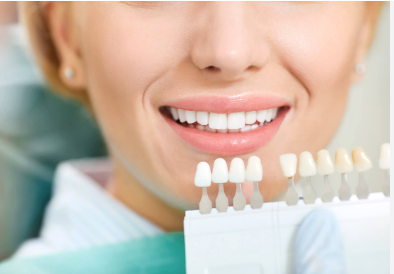 Teeth Whitening Costs in Birmingham