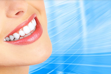 Teeth Whitening Costs in Dallas