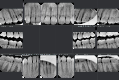 Dental Code for FMX