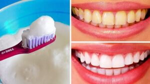 Easy Teeth Whitening