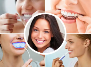 Teeth Whitening at Home