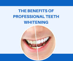 Teeth Whitening Benefits