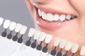 Teeth Whitening Treatment