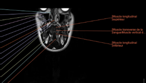 Dental Code IRM