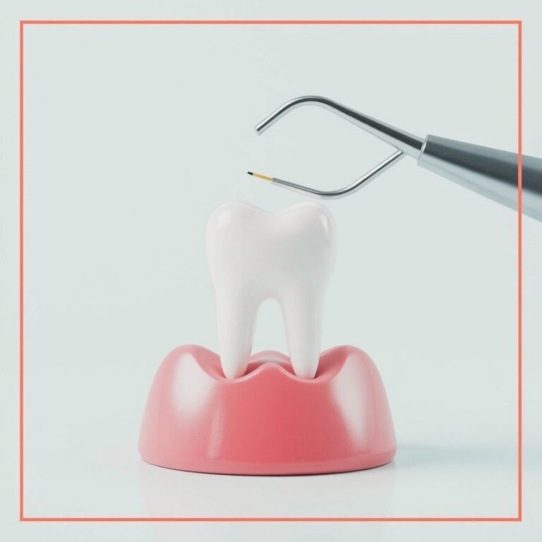 Dental Tooth Filling Costs in London