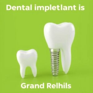 Dental Implant Cost in Grand Rapids