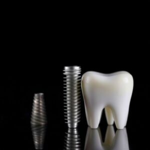 Dental Implant Costs in Manitoba
