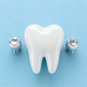 Cheapest Dental Implants in Phoenix