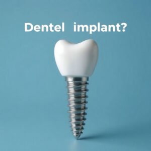 Cost of a Dental Implant Post