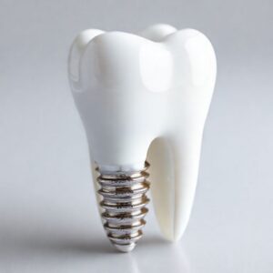 cost of dental implant for one molar tooth