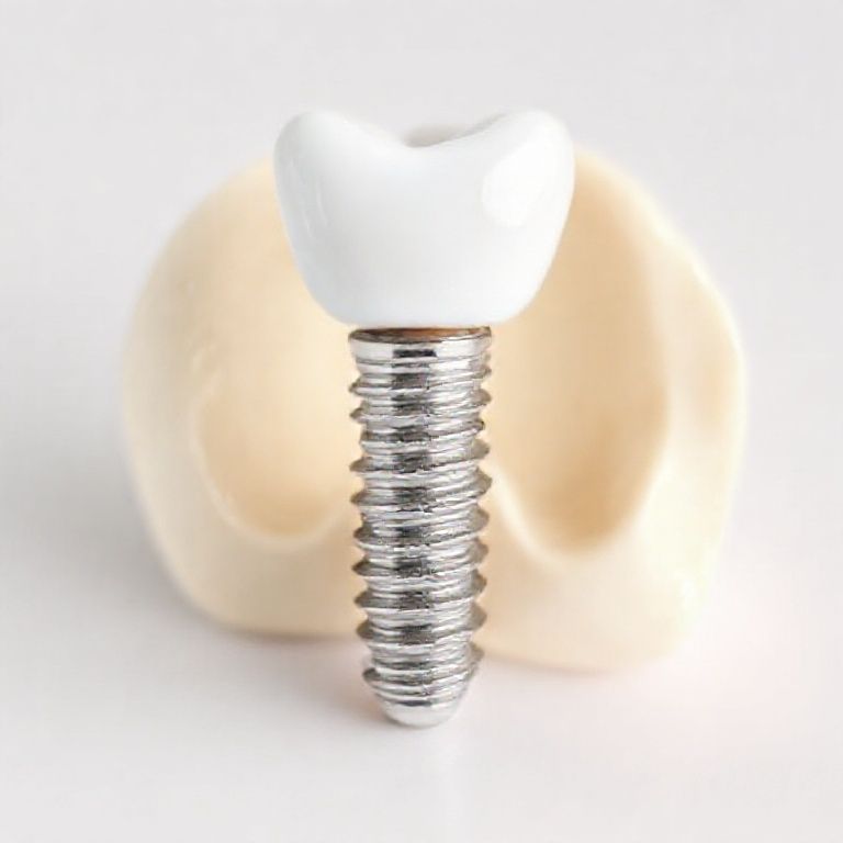 dental implant costs in Oklahoma City