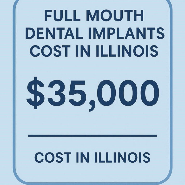 Full Mouth Dental Implants Cost in Illinois