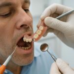 Dental Code D5211: Your Complete Guide to a Mandibular Partial Denture