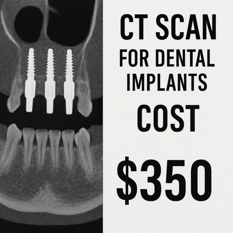 CT Scan for Dental Implants Cost