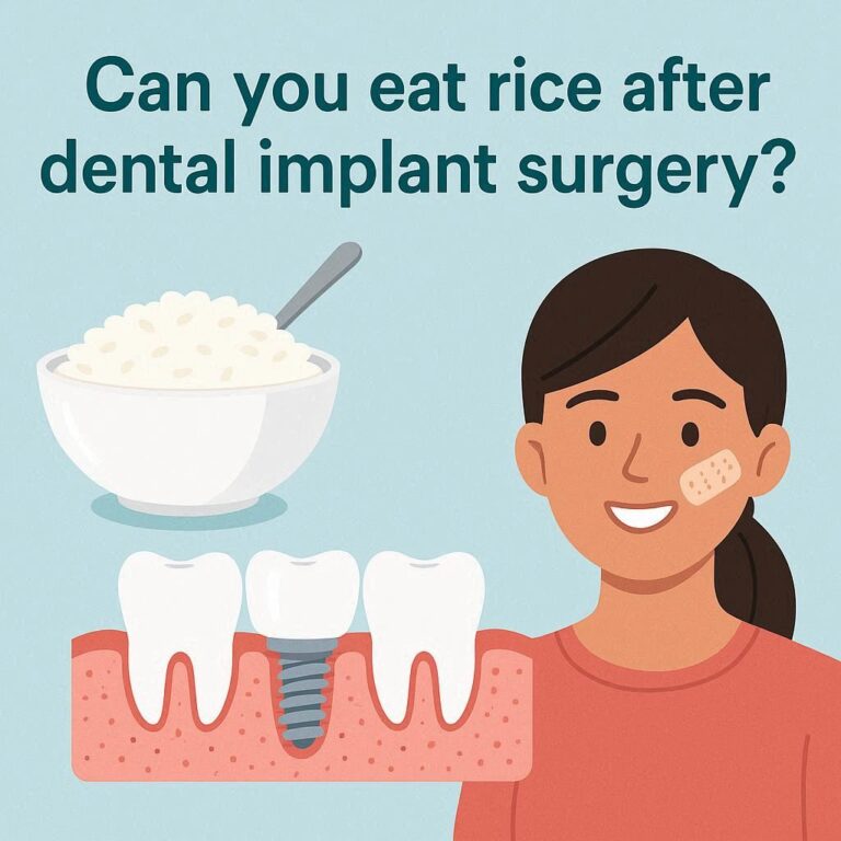 Can You Eat Rice After Dental Implant Surgery?