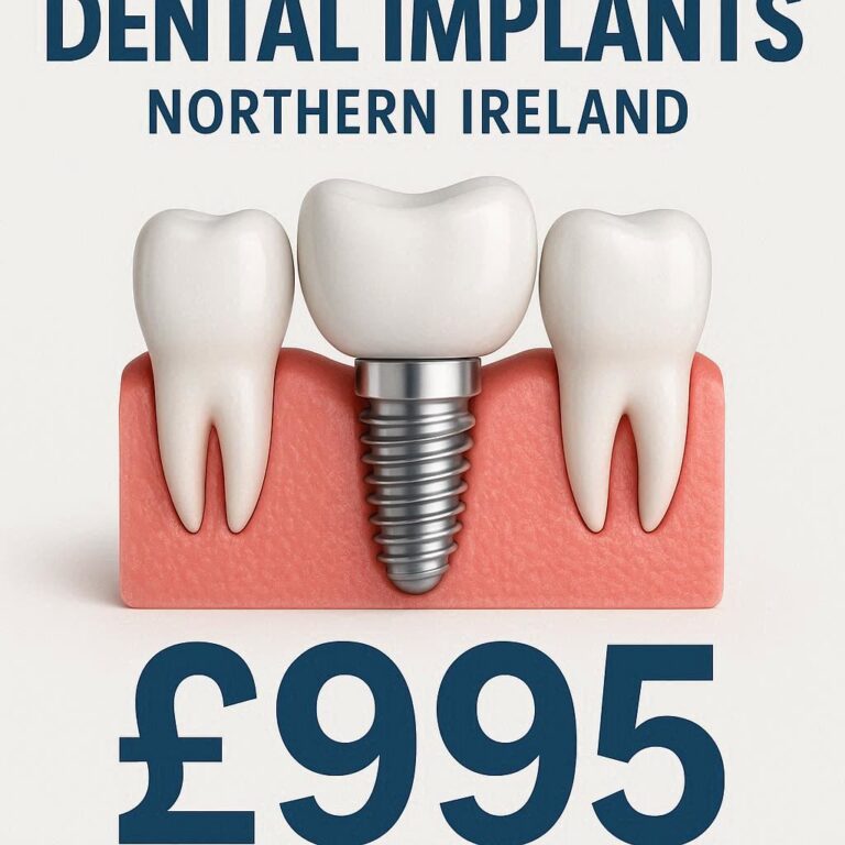 Cheapest Dental Implants Northern Ireland