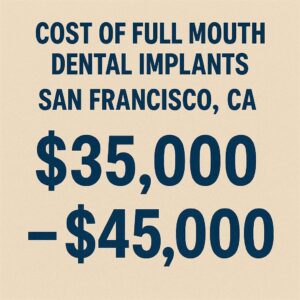Cost Of Full Mouth Dental Implants San Francisco CA
