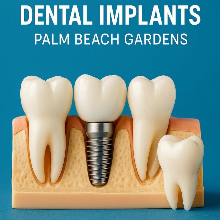 Dental Implants Palm Beach Gardens