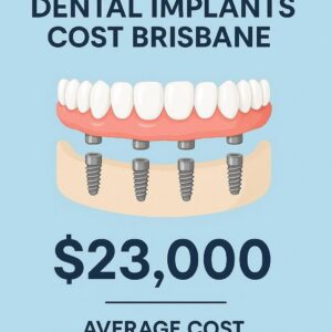 Full Mouth Dental Implants Cost Brisbane