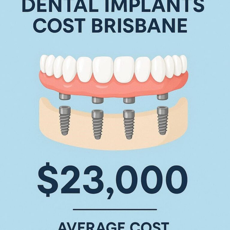 Full Mouth Dental Implants Cost Brisbane