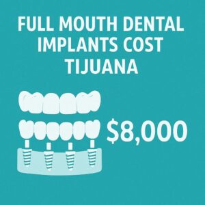 Full Mouth Dental Implants Cost Tijuana