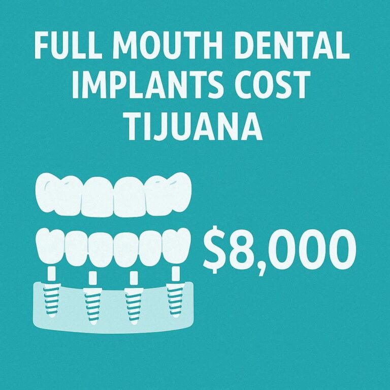 Full Mouth Dental Implants Cost Tijuana