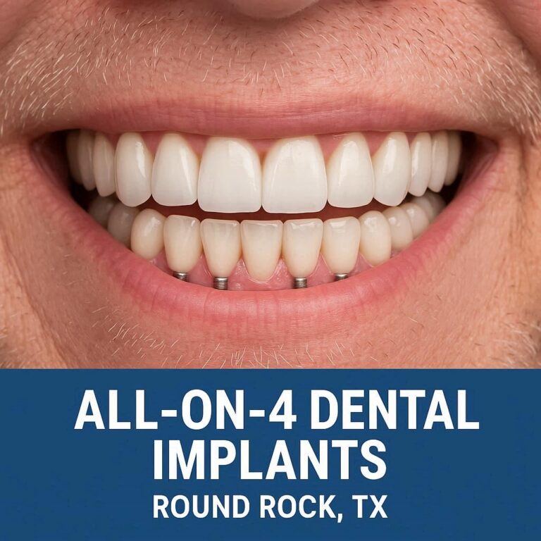 All on 4 Dental Implants in Round Rock TX