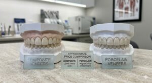 Composite vs Porcelain Veneers Price