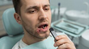 Can You Vape After Dental Implants?