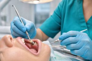 How To Remove Dried-On Plaque From Dental Implants